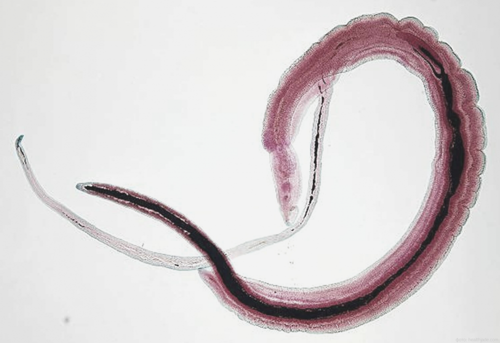 Человеческий герпесвирус типа 8 (HHV-8; герпес-вирус саркомы Капоши), Clonorchis sinensis и Schistosoma haematobium