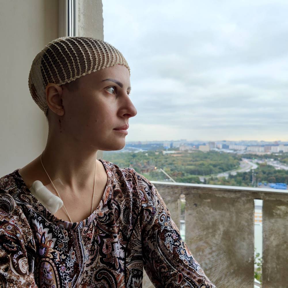Саркома мягких тканей головы грозила Анастасии Григоренко полным удалением скальпа