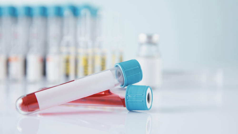 Как выявляют рак предстательной железы